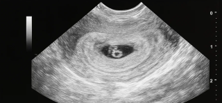 Мар’яна та Олег зі Львова: шлях до довгоочікуваної вагітності з «Лелека прилетить»